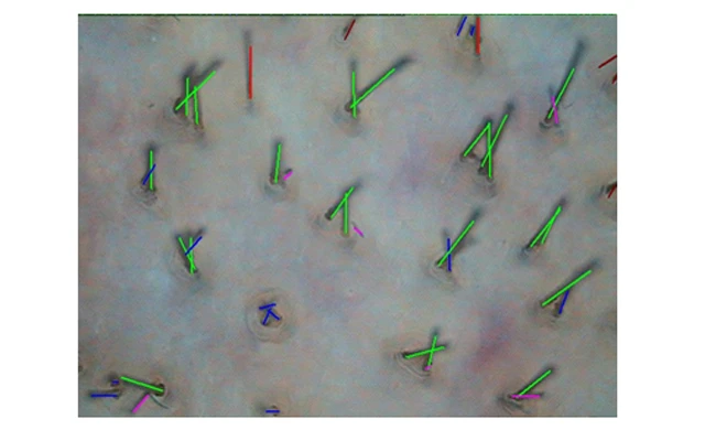 Затылочная зона Затылочная зона