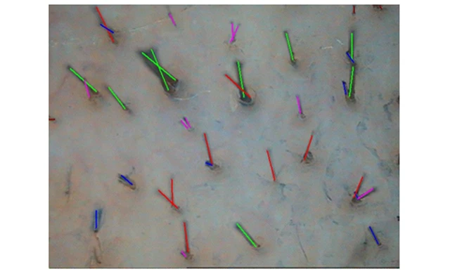 Теменная зона Теменная зона