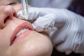 RF и ферментотерапия: как убрать осложнения после контурной коррекции губ